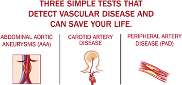 3 tests for vascular disease