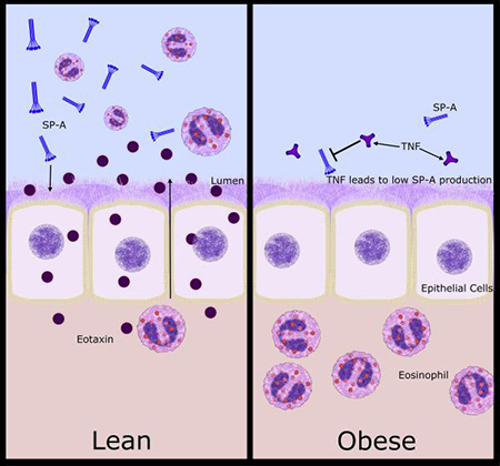 illustration explaining molecular difference in obese, lean asthmatics