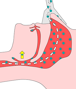 Diagram of how a continuous positive airway pressure (CPAP) device works