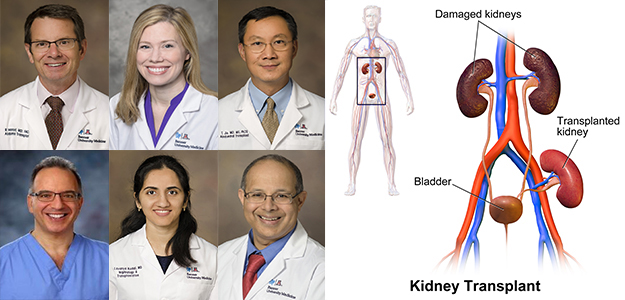 Colllage image for Banner - UMC Tucson kidney transplant team 