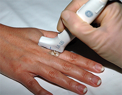 hand undergoing ultrasonography of rheumatologic diseases