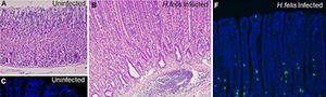 H. felis infection induces G cell and ECL cell hyperplasia in VC:Men1fl/fl; Sst−/− mice. [SOURCE: Gut]