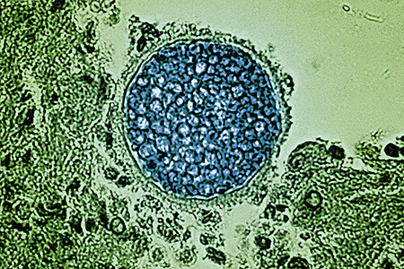 [A Coccidioides fungal spherule (blue) found in a tissue sample. This organism causes coccidioidomycosis, also known as Valley fever. (Credit: micrograph by CDC; colorization and visual effects by NIH/NIAID)]