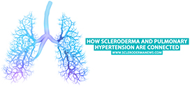 Illustration from Scleroderma News website on how scleroderma and pulmonary hypertension are connected