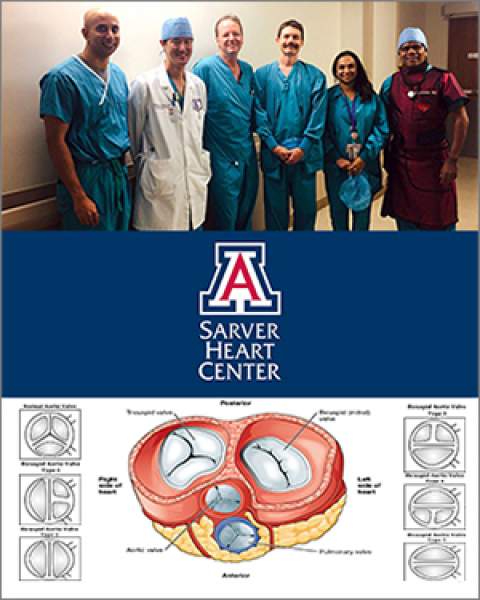 Teaser image for UA Structural Heart Disease Team's first-ever bicuspid TAVR-TEE procedure with no contrast