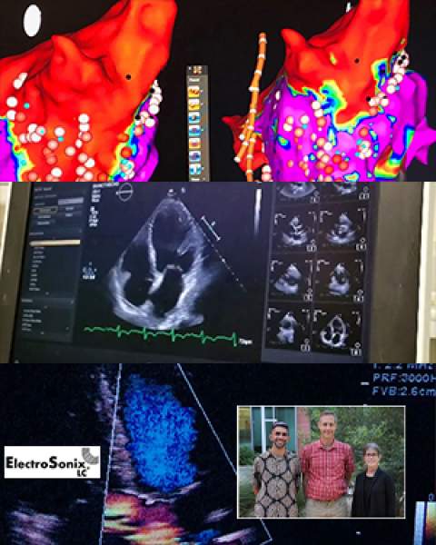 Teaser image for story on ElectroSonix LC licensing acoustoelectric imaging technology from University of Arizona for cardiac and brain procedures