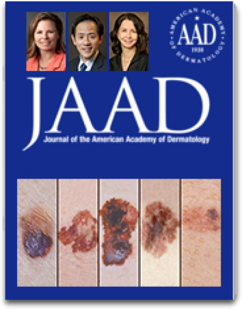 Teaser image for new care guidelines for primary cutaneous melanoma, co-authored by Dr. Clara Curiel, of the UA Division of Dermatology
