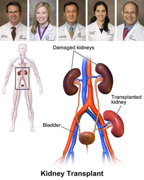 Teaser image for Banner - UMC Tucson kidney transplant team 