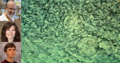 [CDC image of coccidioides, the fungal spores that cause Valley fever, and portraits of (top to bottom) John Galgiani, MD, Anne Wertheimer, PhD, and Lisa Shubitz, DVM]