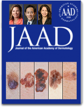 Teaser image for new care guidelines for primary cutaneous melanoma, co-authored by Dr. Clara Curiel, of the UA Division of Dermatology