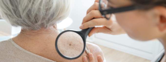 The Department of Medicine’s Division of Dermatology at the University of Arizona College of Medicine – Tucson is launching a research program devoted to aging skin, bringing the emerging field of geriatric dermatology to Southern Arizona.