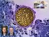 [NIH/NIAID microscopy image of coccidioides fungal spore, which causes Valley fever, with images of U of A's Dr. John Galgiani in his lab and two Congressmen who introduced new legislation for a human vaccine]