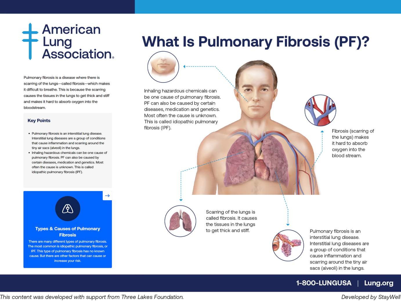 [American Lung Association flyer on pulmonary fibrosis or lung scarring that is a primary characteristic of people suffering from interstitial lung diseases affecting more than 650,000 people in the U.S.]